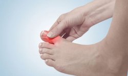 Как болят суставы на ногах симптомы
