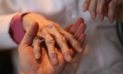 Полиартрит пальцев рук: симптомы, лечение и причины возникновения