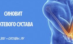 Синовит локтевого сустава: лечение, симптомы, причины