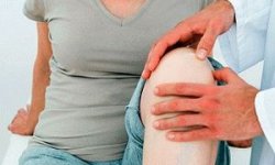 Как избавиться от хруста в коленях