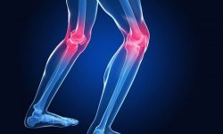 Горят колени: причины, лечение, диагностика проблемы