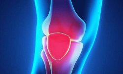 Болезни суставов коленей: их симптомы и эффективное лечение