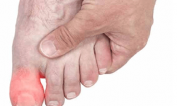 Почему болят пальцы на ногах при ходьбе