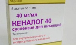 Кеналог (уколы 40 мг и таблетки): инструкция по применению, отзывы врачей и пациентов, аналоги