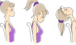Гимнастика для шеи: упражнения, зарядка для укрепления и гибкости мышц, ЛФК