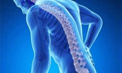 Эпифизарный остеопороз: как лечить, причины, симптомы