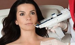 Мезотерапия: для тех, кто впервые идет к косметологу