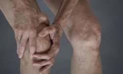 Остеоартрит коленного сустава: лечение, симптомы и причины