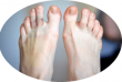 Ушибы пальцев ног, отличие от перелома: диагностика, первая помощь и лечение