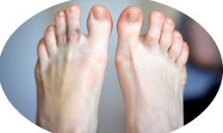 Ушибы пальцев ног, отличие от перелома: диагностика, первая помощь и лечение