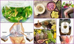 Травы для лечения артроза суставов: настойки, отвары, компрессы