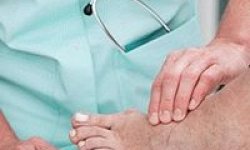 Боль в суставе большого пальца ноги лечение