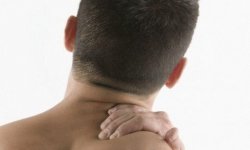 Шейная мигрень симптомы и лечение — причины синдрома Барре Льеу