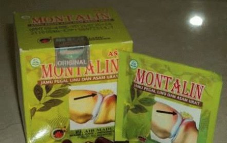 Монталин — лекарство для суставов: инструкция, побочные эффекты