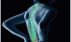 Почему болит спина в области поясницы: основные причины