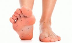 Болезни суставов ног: лечение, симптомы, причины