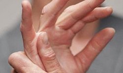 Щелкающий палец: лечение без операции в домашних условиях, почему он щелкает