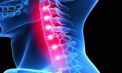 Как проходит восстановление спинного мозга после травм: виды повреждений, диагностика, возможность лечения