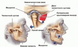 Остеоартроз ВНЧС: лечение, причины, профилактика