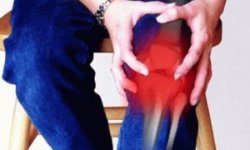 Эпикондилит коленного сустава: причины развития, симптомы, лечение