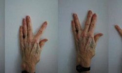 Лечебная гимнастика для пальцев рук: эффективность