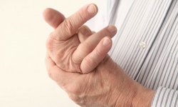 Первые признаки артрита и артроза суставов рук