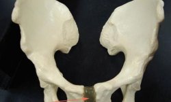Лонное сочленение: анатомия, функции, лечение лобкового симфиза