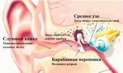 Перелом уха: симптомы, лечение и восстановление