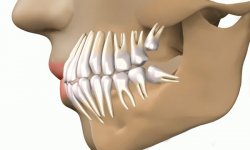 Боль в суставе челюсти возле уха