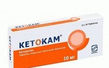 Кетокам: от чего эти таблетки, инструкция по применению от головной и зубной боли