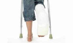 Открытый и закрытый перелом ноги: симптомы