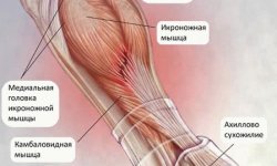 Растяжение икроножной мышцы: симптомы, лечение, причины