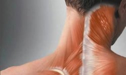 Растяжение связок шеи: симптомы, лечение, профилактика