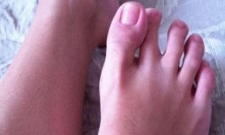 Почему сводит пальцы на ногах: причины судорог в ступнях, что делать