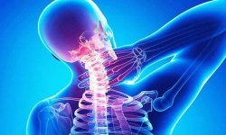 На что влияет шейный остеохондроз: неврология, нервная система