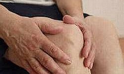 Ревматоїдний артрит симптоми