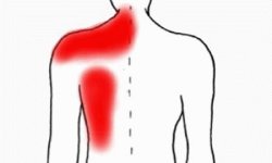 Боль под левой лопаткой сзади со спины: причины и лечение