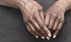 Хламидийный артрит: симптомы, лечение и причины болезни