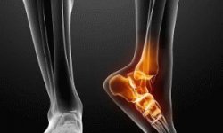 Рентген ноги: что показывает процедура и как ее делают