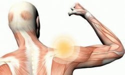 Плексопатия плечевого сплетения, лечение посттравматической плечевой плексопатии