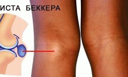 Болит колено при сгибании и ходьбе лечение