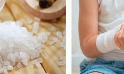 Лечение артроза солью: ванночки и компрессы для суставов